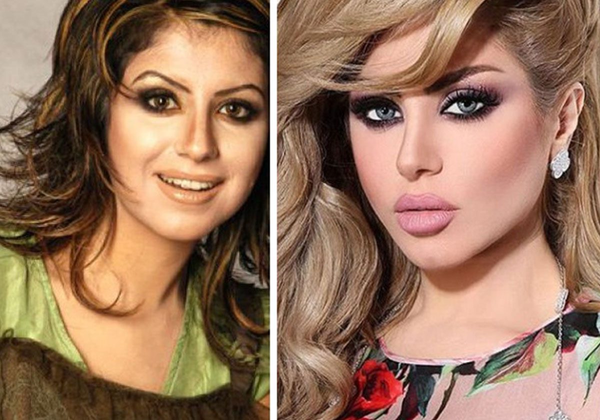 حليمة بولند قبل وبعد