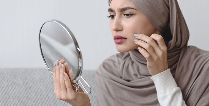 أسباب تعزز ظهور البثور وحب الشباب عليك تجنبها