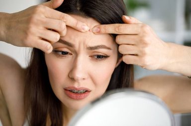 طريقة علاج حبوب الجبين