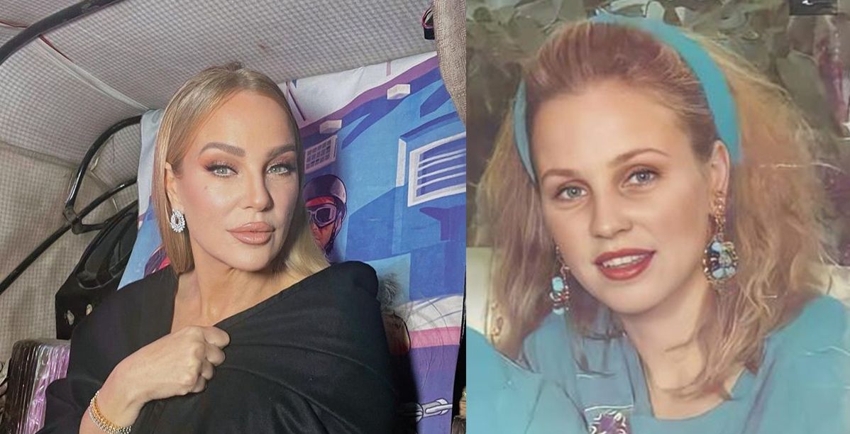 النجمات قبل عمليات التجميل